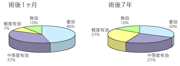 下甲介粘膜焼灼術