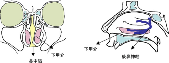 花粉 症 手術