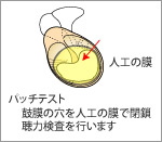 慢性中耳炎の検査