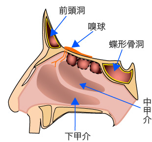 副鼻腔炎